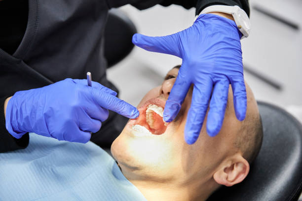 Best Broken or Chipped Tooth Repair in Cosmopolis, WA